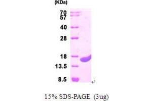 SDS-PAGE (SDS) image for Protein CutA (CUTA) (AA 33-179) protein (His tag) (ABIN666985)