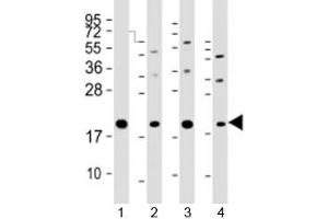 Western blot testing of human 1) HeLa, 2) PC-3, 3) T47D and 4) U-2OS cell lysate with APC11 antibody at 1:2000. (ANAPC11 Antikörper  (AA 56-94))