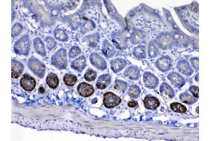 Immunohistochemistry (IHC) image for anti-Insulin-Like Growth Factor 1 Receptor (IGF1R) (AA 31-257) antibody (ABIN5519001)