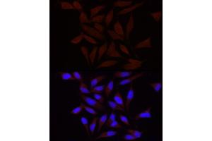 Immunofluorescence (IF) image for anti-Piezo-Type Mechanosensitive Ion Channel Component 1 (PIEZO1) (AA 2230-2420) antibody (ABIN6145612)