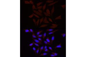 Immunofluorescence analysis of HeLa using FA/PIEZO1 antibody (ABIN6133207, ABIN6145612, ABIN6145613 and ABIN6220594) at dilution of 1:100 (40x lens). (PIEZO1 Antikörper  (AA 2230-2420))
