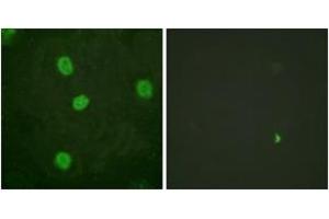 Immunofluorescence analysis of HeLa cells, using B-Myb (Phospho-Ser577/581) Antibody. (MYBL2 Antikörper  (pSer577))