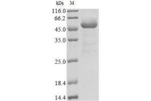 (Tris-Glycine gel) Discontinuous SDS-PAGE (reduced) with 5 % enrichment gel and 15 % separation gel. (SARS-CoV-2 Nucleocapsid Protein (SARS-CoV-2 N) (AA 1-419) (His tag))
