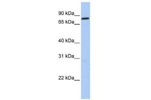 WB Suggested Anti-ZNF226 Antibody Titration:  0. (ZNF226 Antikörper  (C-Term))