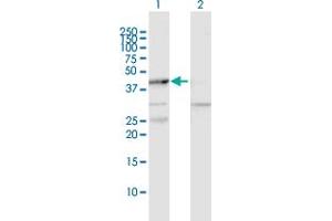 Western Blot analysis of MAPKAPK2 expression in transfected 293T cell line by MAPKAPK2 MaxPab polyclonal antibody. (MAPKAP Kinase 2 Antikörper  (AA 1-400))