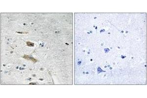 Immunohistochemistry analysis of paraffin-embedded human brain tissue, using ABHD4 Antibody. (ABHD4 Antikörper  (AA 251-300))