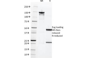 SDS-PAGE Analysis of Purified HCG-beta Rabbit Recombinant Monoclonal Antibody (HCGb/1996R).
