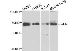 Western Blotting (WB) image for anti-Glutaminase (GLS) (AA 610-669) antibody (ABIN1680034)