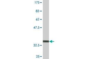 Western Blotting (WB) image for anti-serpin Peptidase Inhibitor, Clade E (Nexin, Plasminogen Activator Inhibitor Type 1), Member 2 (SERPINE2) (AA 72-172) antibody (ABIN518872)