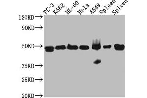 Western Blot Positive WB detected in: PC-3 whole cell lysate, K562 whole cell lysate, HL-60 whole cell lysate, A549 whole cell lysate, Mouse Spleen whole cell lysate, Rat Spleen whole cell lysate All lanes: Arp3 Antibody at 1:1000 Secondary Goat polyclonal to rabbit IgG at 1/50000 dilution Predicted band size: 48 kDa Observed band size: 48 kDa (Rekombinanter ACTR3 Antikörper)