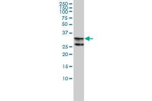 HNRPA2B1 monoclonal antibody (M01A), clone 1G12-6C5 Western Blot analysis of HNRPA2B1 expression in K-562 . (HNRNPA2B1 Antikörper  (AA 1-249))