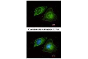 ICC/IF Image Immunofluorescence analysis of methanol-fixed HeLa, using MMP17, antibody at 1:200 dilution.