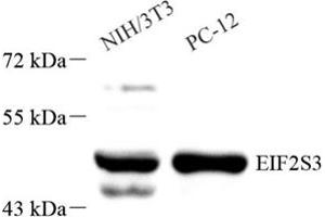 Western Blotting (WB) image for anti-Eukaryotic Translation Initiation Factor 2, Subunit 3 Gamma, 52kDa (EIF2S3) antibody (ABIN7073881)