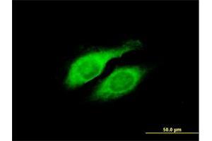 Immunofluorescence of purified MaxPab antibody to LYPLA2 on HeLa cell.