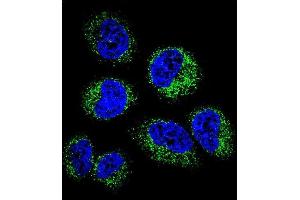 Confocal immunofluorescent analysis of GGH Antibody (C-term) (ABIN655984 and ABIN2845368) with NCI- cell followed by Alexa Fluor 488-conjugated goat anti-rabbit lgG (green). (GGH Antikörper  (C-Term))