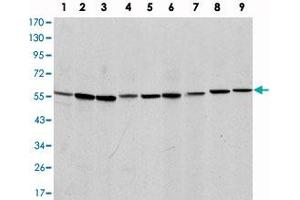 Western blot analysis using AIFM1 monoclonal antibody, clone 4E7  against NIH/3T3 (1), Jurkat (2), HeLa (3), HepG2 (4), MOLT 4 (5), C6 (6), Raji (7), COS-7 (8) and PC-12 (9) cell lysate. (AIF Antikörper)