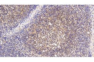 Detection of EP300 in Human Lymph node Tissue using Polyclonal Antibody to E1A Binding Protein P300 (EP300) (p300 Antikörper  (AA 1351-1601))