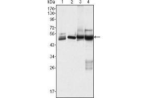 Western blot analysis using CK7 mouse mAb against Hela (1), MCF-7 (2), A431 (3) and A549 (4) cell lysate. (Cytokeratin 7 Antikörper)