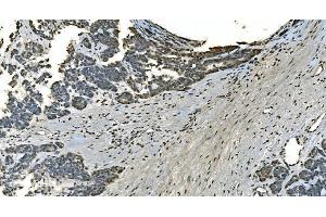 IHC analysis of LSM8 using anti-LSM8 antibody (ABIN7599579). (NAA38 Antikörper  (AA 1-96))