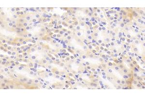 Detection of b2M in Mouse Kidney Tissue using Polyclonal Antibody to Beta-2-Microglobulin (b2M) (beta-2 Microglobulin Antikörper  (AA 22-119))