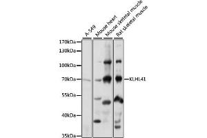 Western blot analysis of extracts of various cell lines, using KLHL41 antibody (ABIN7268084) at 1:1000 dilution. (Kelch-like protein 41 (KLHL41) (AA 1-300) Antikörper)