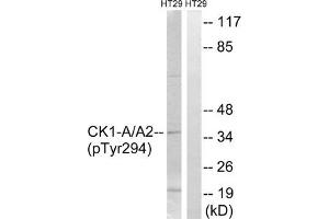 Western blot analysis of extracts from HT-29 cells treated with heat shock using CK-1α (Phospho-Tyr294) Antibody. (CSNK1A1 Antikörper  (pTyr294))