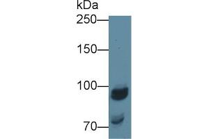 Detection of NAGLU in Porcine Kidney lysate using Polyclonal Antibody to N-Acetyl Alpha-D-Glucosaminidase (NAGLU) (N-Acetyl alpha-D-Glucosaminidase (AA 485-743) Antikörper)
