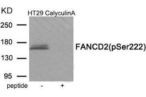 Western blot analysis of extracts from HT29 cells treated with CalyculinA using Phospho-FANCD2 (Ser222) antibody. (FANCD2 Antikörper  (pSer222))