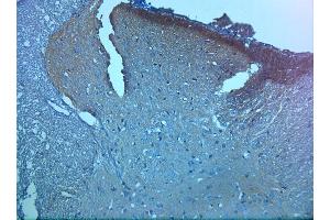 IHC on paraffin sections of rat spinal cord tissue using Rabbit antibody to pro BDNF (50-90): . (Pro BDNF Antikörper)