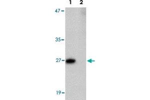 Western blot analysis of PRTFDC1 in human brain tissue lysate with PRTFDC1 polyclonal antibody  at 1 ug/mL in the (Lane 1) absence and (Lane 2) presence of blocking peptide. (PRTFDC1 Antikörper  (Internal Region))