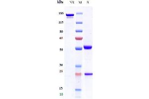 Anti-CD4 Reference Antibody (TRX1) on SDS-PAGE under reducing (R) condition.