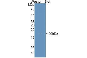 Western blot analysis of the recombinant protein. (IL1F9 Antikörper  (AA 5-153))