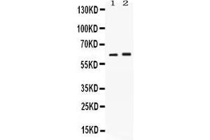 Western blot analysis of SCTR expression in rat kidney extract ( Lane 1) and SKOV3 whole cell lysates ( Lane 2). (SCTR Antikörper  (C-Term))