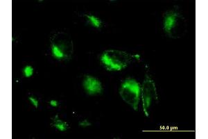 Immunofluorescence (IF) image for anti-Syntaxin 6 (STX6) (AA 1-255) antibody (ABIN564427)