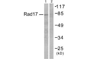Western blot analysis of extracts from RAW264. (ABHD14A Antikörper  (C-Term))