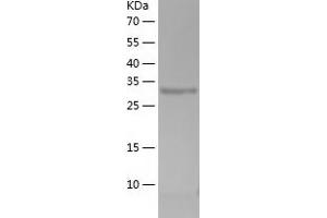 Decorin (DCN) (AA 31-359) protein (His-IF2DI Tag)