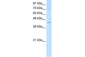 Western Blotting (WB) image for anti-Nuclear RNA Export Factor 5 (NXF5) antibody (ABIN2462318)