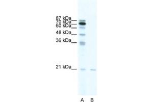 Western Blotting (WB) image for anti-SCAN Domain Containing 1 (SCAND1) antibody (ABIN2461245) (SCAND1 Antikörper)