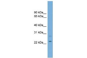 WB Suggested Anti-RBM11 Antibody Titration: 0. (RBM11 Antikörper  (Middle Region))