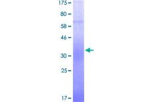 Image no. 1 for CD28 (CD28) (AA 18-152) protein (His-DYKDDDDK-Strep II Tag) (ABIN1348597)