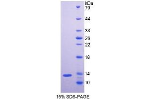 SDS-PAGE (SDS) image for Neurofilament, Light Polypeptide (NEFL) (AA 139-234) protein (His tag) (ABIN1099338) (NEFL Protein (AA 139-234) (His tag))