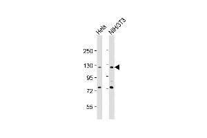All lanes : Anti-TK Antibody (N-Term) at 1:2000 dilution Lane 1: Hela whole cell lysates Lane 2: NIH/3T3 whole cell lysates Lysates/proteins at 20 μg per lane. (AATK Antikörper  (AA 55-90))
