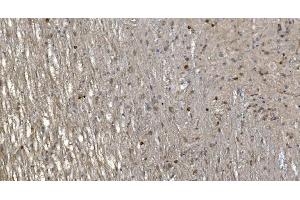 IHC analysis of Alpha B Crystallin/CRYAB using anti-Alpha B Crystallin/CRYAB antibody (ABIN7601209). (CRYAB Antikörper  (AA 30-151))