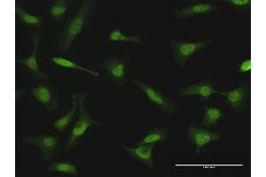 Immunofluorescence of purified MaxPab antibody to NME1 on HeLa cell. (NME1 Antikörper  (AA 1-177))