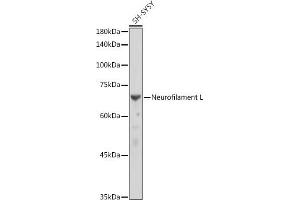 Western blot analysis of extracts of SH-SY5Y cells, using Neurofilament L antibody (ABIN7268867) at 1:10000 dilution. (NEFL Antikörper)