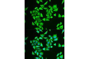 Immunofluorescence analysis of U2OS cells using PGM1 antibody. (Phosphoglucomutase 1 Antikörper  (AA 1-300))