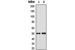 Western blot analysis of Septin 8 expression in HeLa (A), mouse brain (B) whole cell lysates.