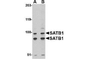 Western Blotting (WB) image for anti-SATB Homeobox 1 (SATB1) (C-Term) antibody (ABIN1030642) (SATB1 Antikörper  (C-Term))