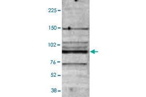 B : Western blot was performed on nuclear extracts from the U-937 (human leukemic monocyte lymphoma cell line ; 40 ug) with MBD4 polyclonal antibody , diluted 1 : 2,000 in TBST containing 3% milk powder. (MBD4 Antikörper)
