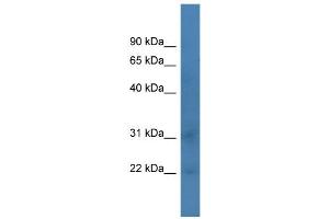 Western Blotting (WB) image for anti-TAF12 RNA Polymerase II, TATA Box Binding Protein (TBP)-Associated Factor, 20kDa (TAF12) (C-Term) antibody (ABIN2777255)